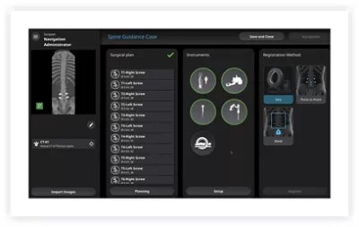 Spine Guidance Software Stryker
